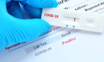 Вся Испания: сколько стоят тесты на коронавирус в Европе - allspain.info - Испания