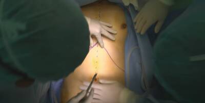 Каролина Дариас - Испанские хирурги за год сделали 4781 трансплантацию - noticia.ru